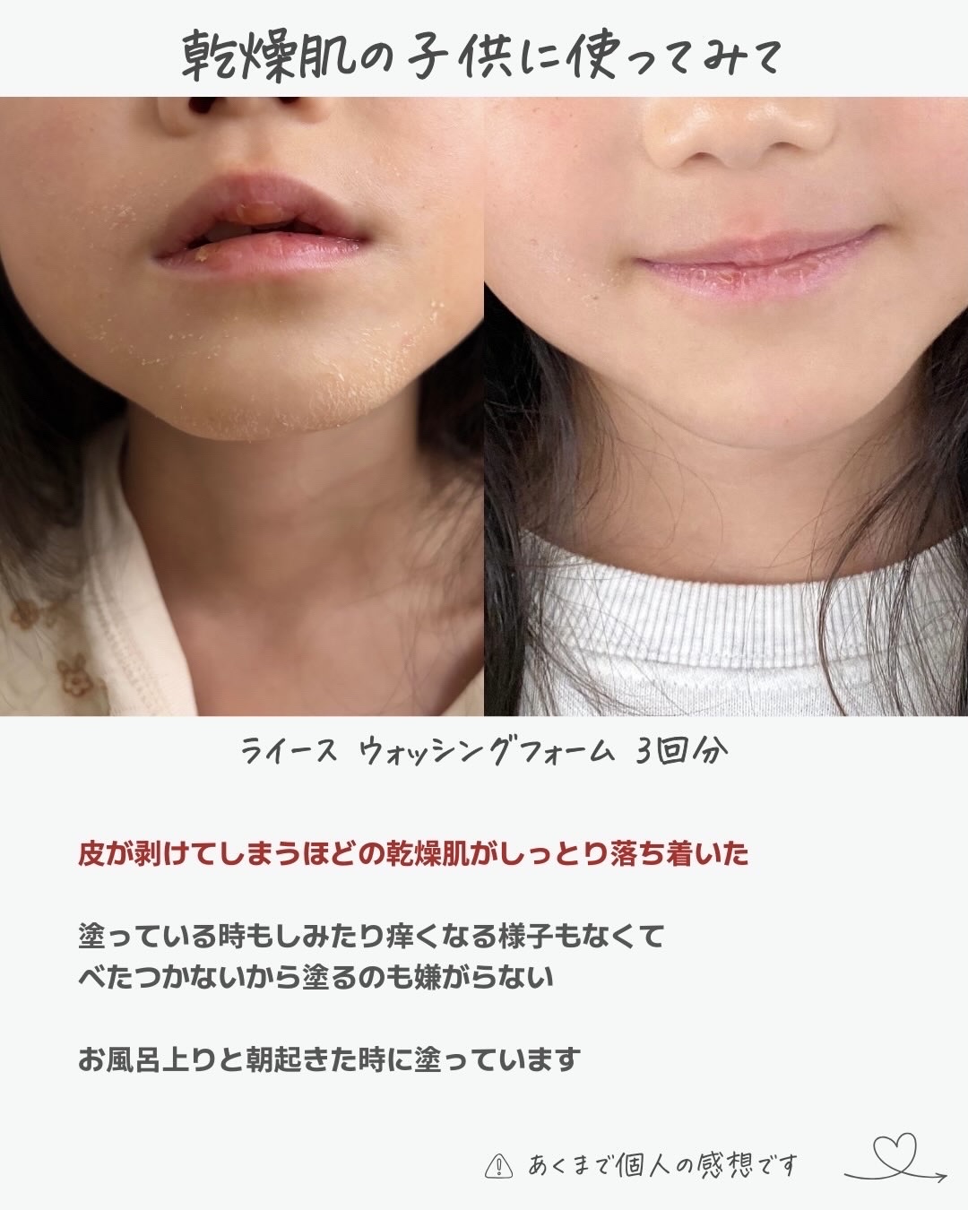 ATOクリーム/lesstopy/ボディクリームを使ったクチコミ（3枚目）