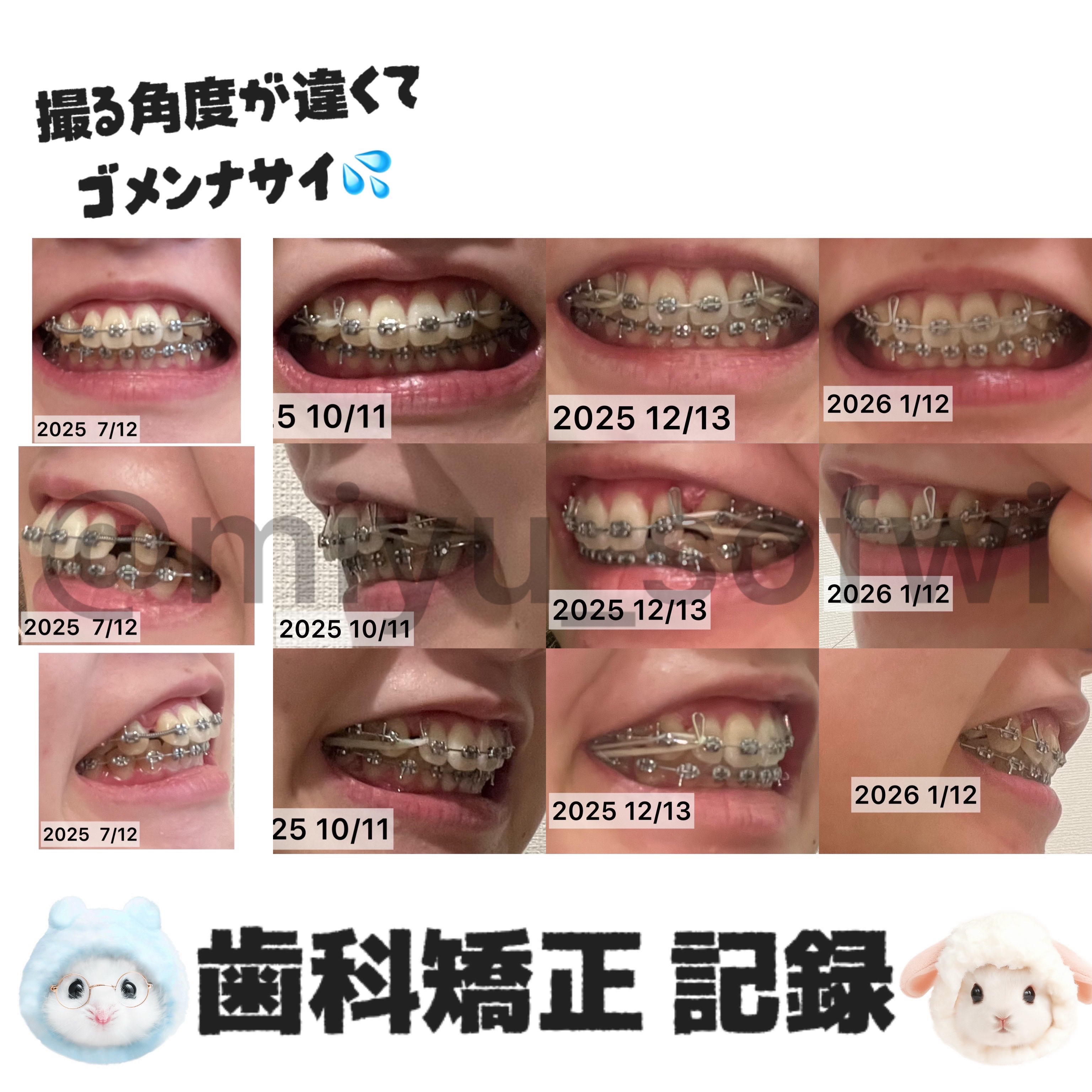 システマハブラシ/システマ/歯ブラシを使ったクチコミ（1枚目）