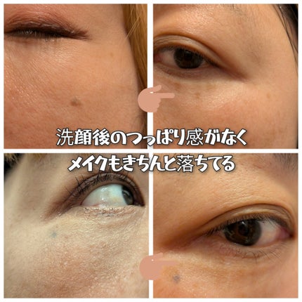 ブラックジェルクレンジング/.akaran/クレンジングジェルを使ったクチコミ(3枚目)