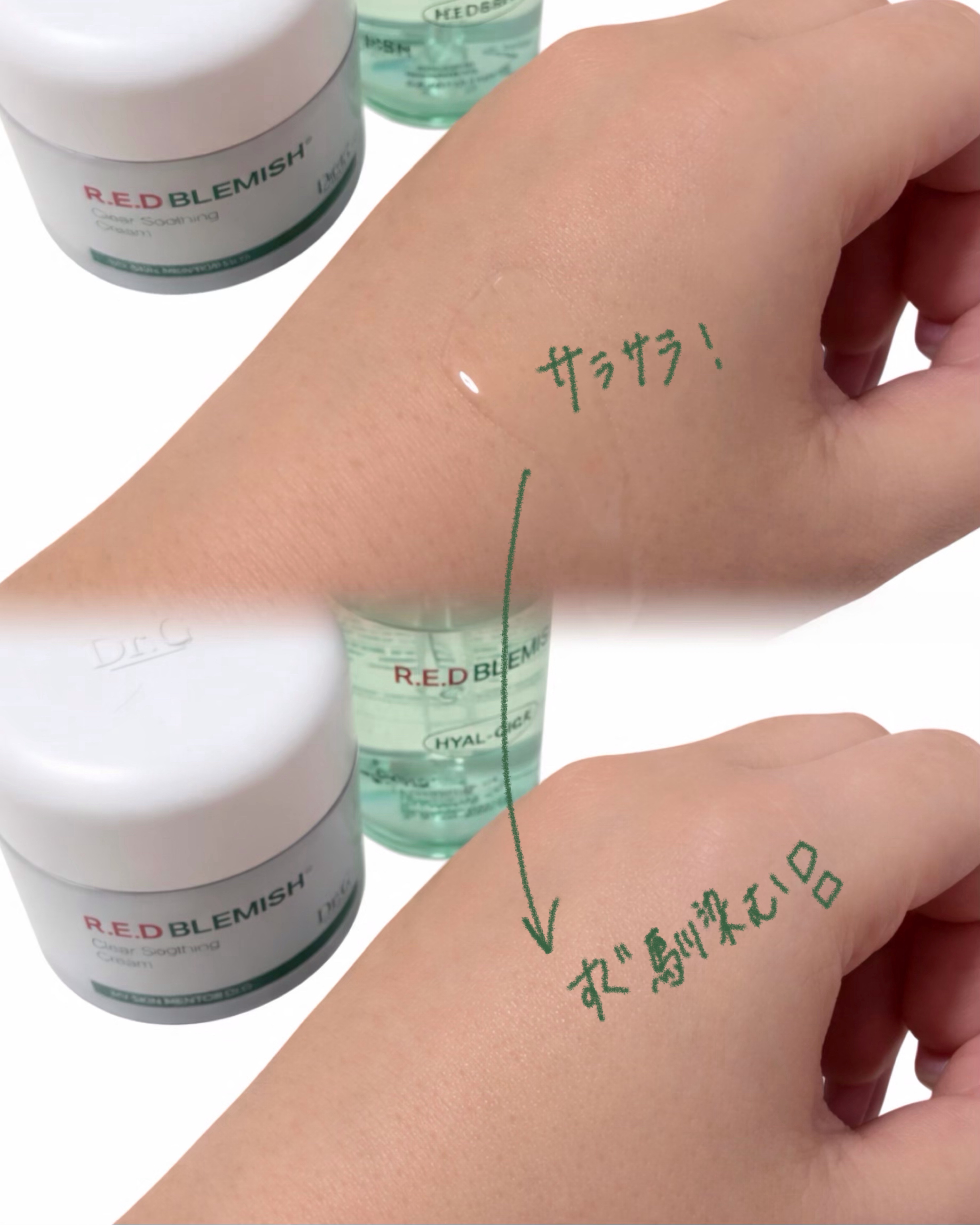 レッドブレミッシュ クリアヒアルシカスージングセラム/Dr.G/美容液を使ったクチコミ（2枚目）