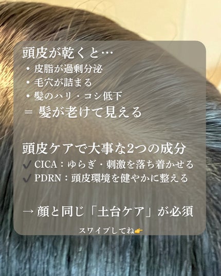 スカルプターンヘアアンプル/リリーイブ/頭皮ローションを使ったクチコミ(3枚目)