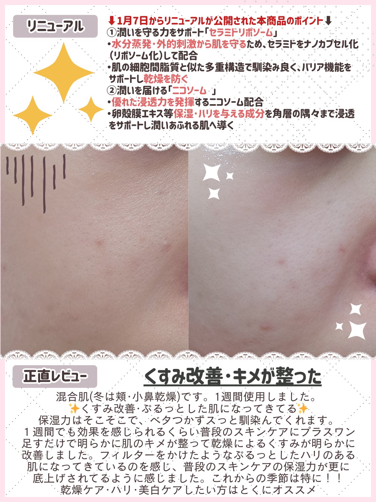 ビューティーオープナーセラム リンクル＆ホワイト/オージオ/美容液を使ったクチコミ（3枚目）