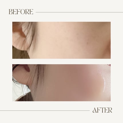 C×AZ ダーマインショット200/ESIENCE/美容液を使ったクチコミ(3枚目)