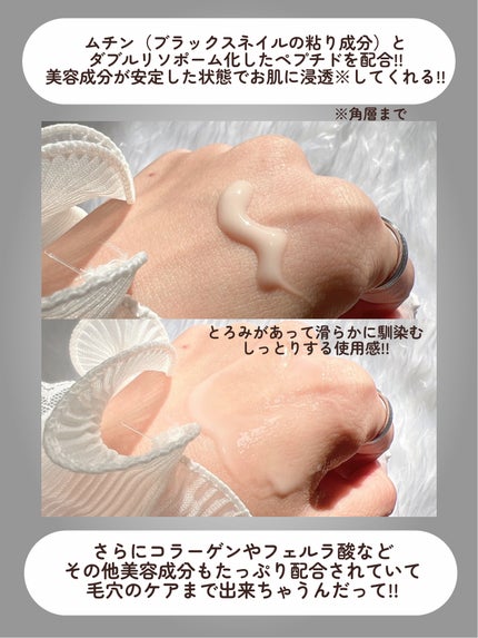 ブラックスネイル クリーム/Dr.G/フェイスクリームを使ったクチコミ(4枚目)