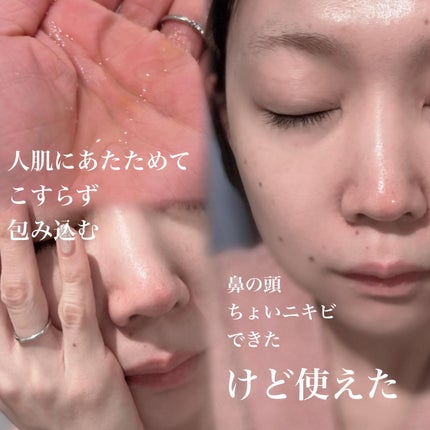 タカミスキンピール/タカミ/ブースター・導入液を使ったクチコミ(2枚目)