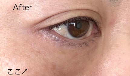 Miaa on LIPS 「以前にも載せたポスポスですが、今回は変化が分かりやすかったので..」(2枚目)