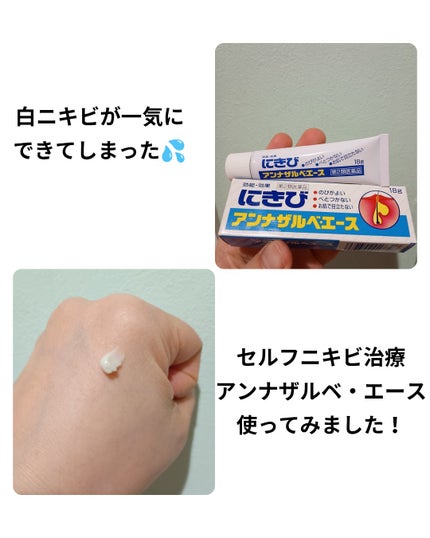 アンナザルベ・エース(医薬品)/エスエス製薬/その他を使ったクチコミ(1枚目)
