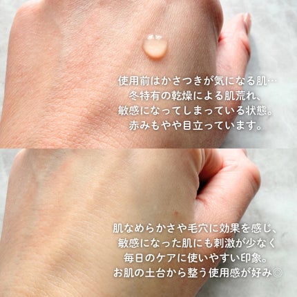 タカミスキンピール/タカミ/ブースター・導入液を使ったクチコミ(2枚目)