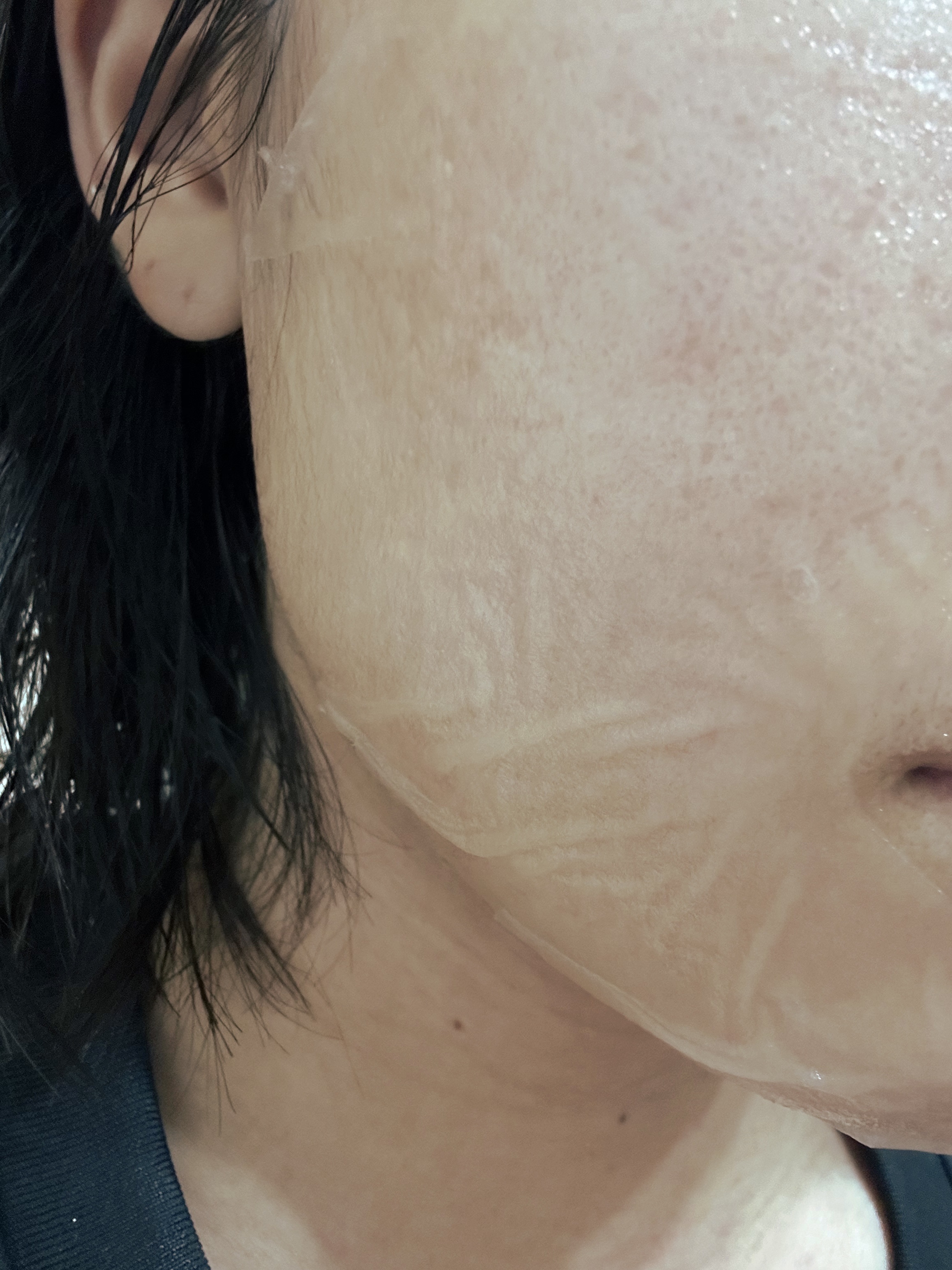 ビタミン10ポアストリクスセラムマスク/Anua/シートマスク・パックを使ったクチコミ（2枚目）