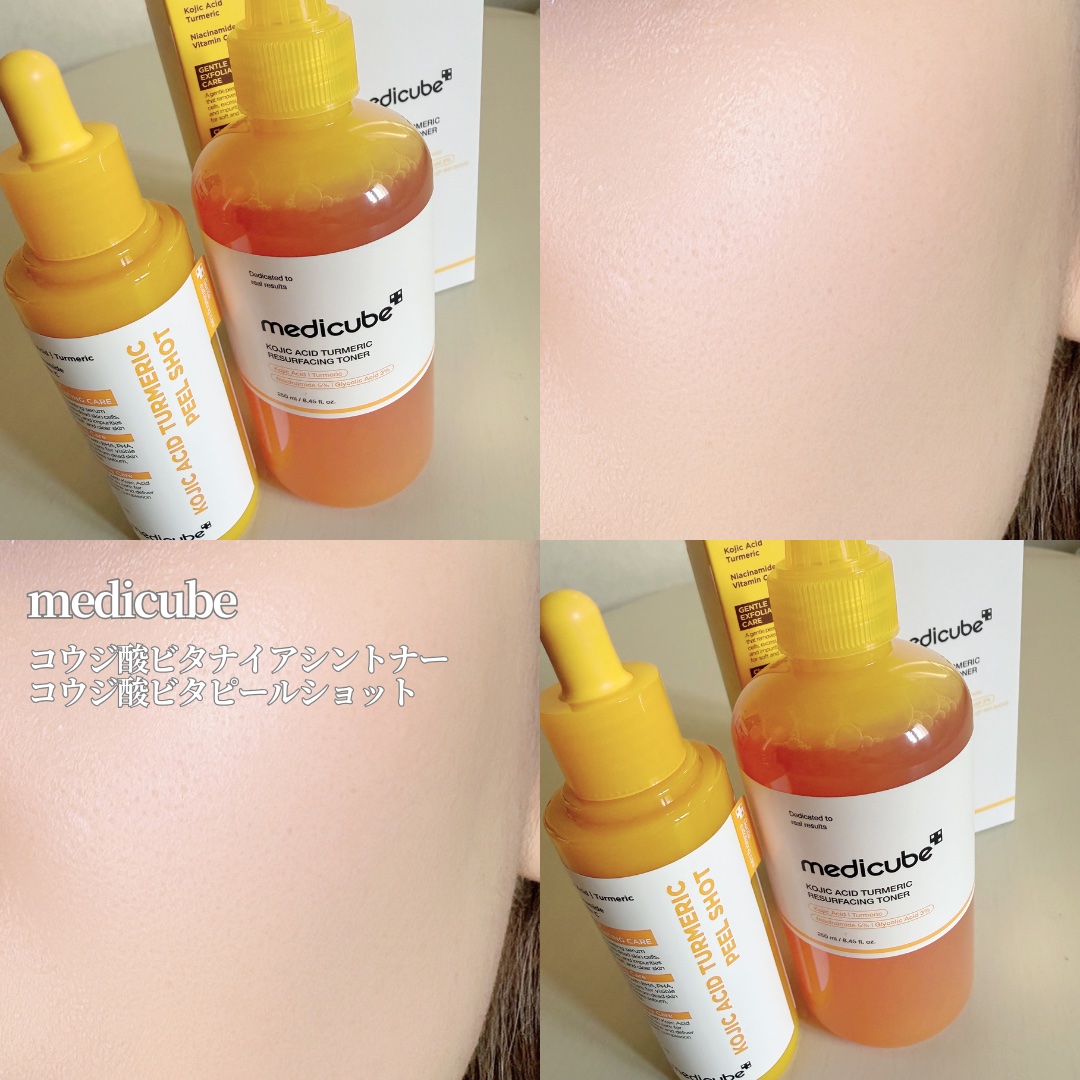 コウジ酸ビタナイアシントナー/MEDICUBE/化粧水を使ったクチコミ（1枚目）