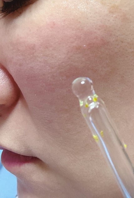 ダーメラ ルミショット・Wビタセラム/Dermela/美容液を使ったクチコミ(4枚目)