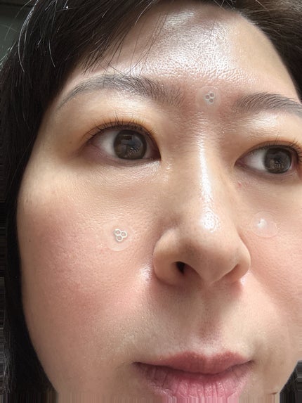 ACマグネシウムパッチ/スノーツープラス/シートマスク・パックを使ったクチコミ(5枚目)