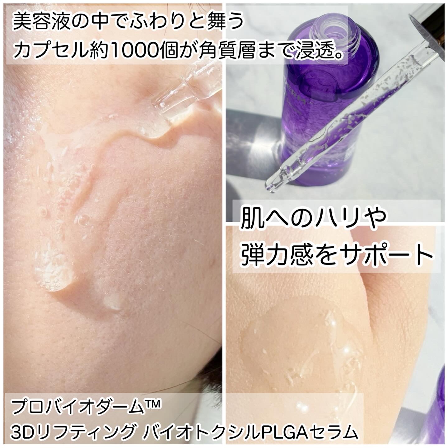 バイオヒールボ プロバイオダーム 3Dリフティングクリーム/BIOHEAL BOH/フェイスクリームを使ったクチコミ（3枚目）