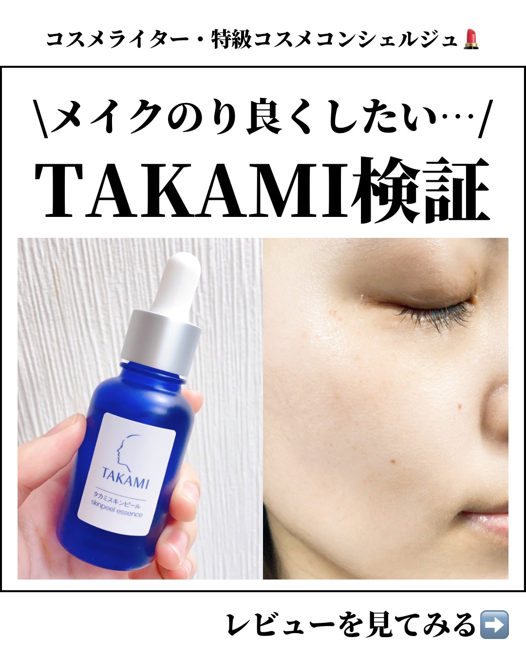 タカミスキンピール/タカミ/ブースター・導入液を使ったクチコミ（1枚目）