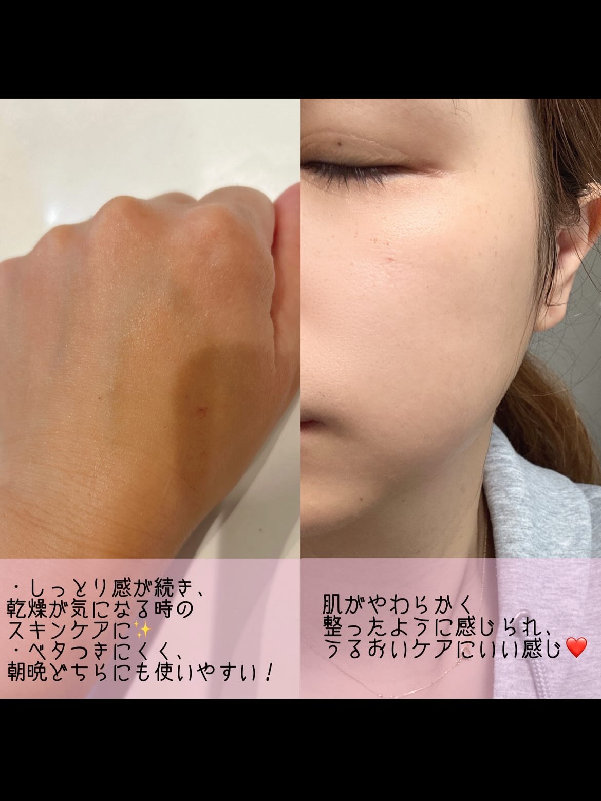 スピテラパーミアPDRNクリーム/NUDIQUE/フェイスクリームを使ったクチコミ（3枚目）