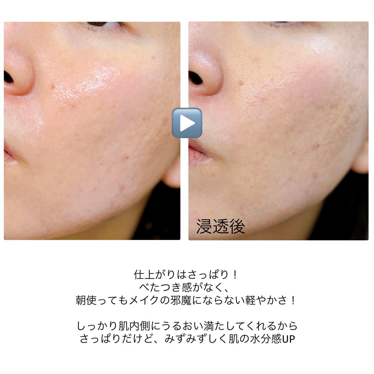 ãã«ãã¹ã¯ãšã¢ã·ãŒããã¹ã¯/Yunth/ã·ãŒããã¹ã¯ã»ããã¯ã䜿ã£ãã¯ãã³ãïŒ8æç®ïŒ