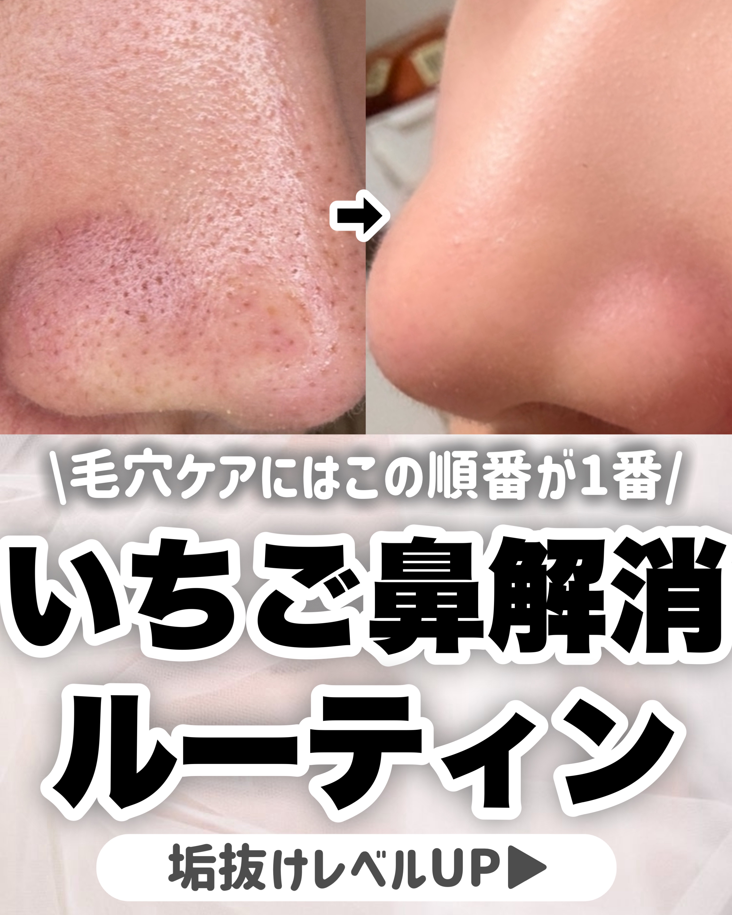 【毛穴ケア】いちご鼻を解消するスキンケアの順番はこれ‼️真似して垢抜ける👌🏻

今回は、

いちご鼻がめちゃくちゃ綺麗になる

スキンケアの順番をご紹介します！


毛穴を綺麗にしたい人は

これを真似してみてー！！！


#毛穴ケア
