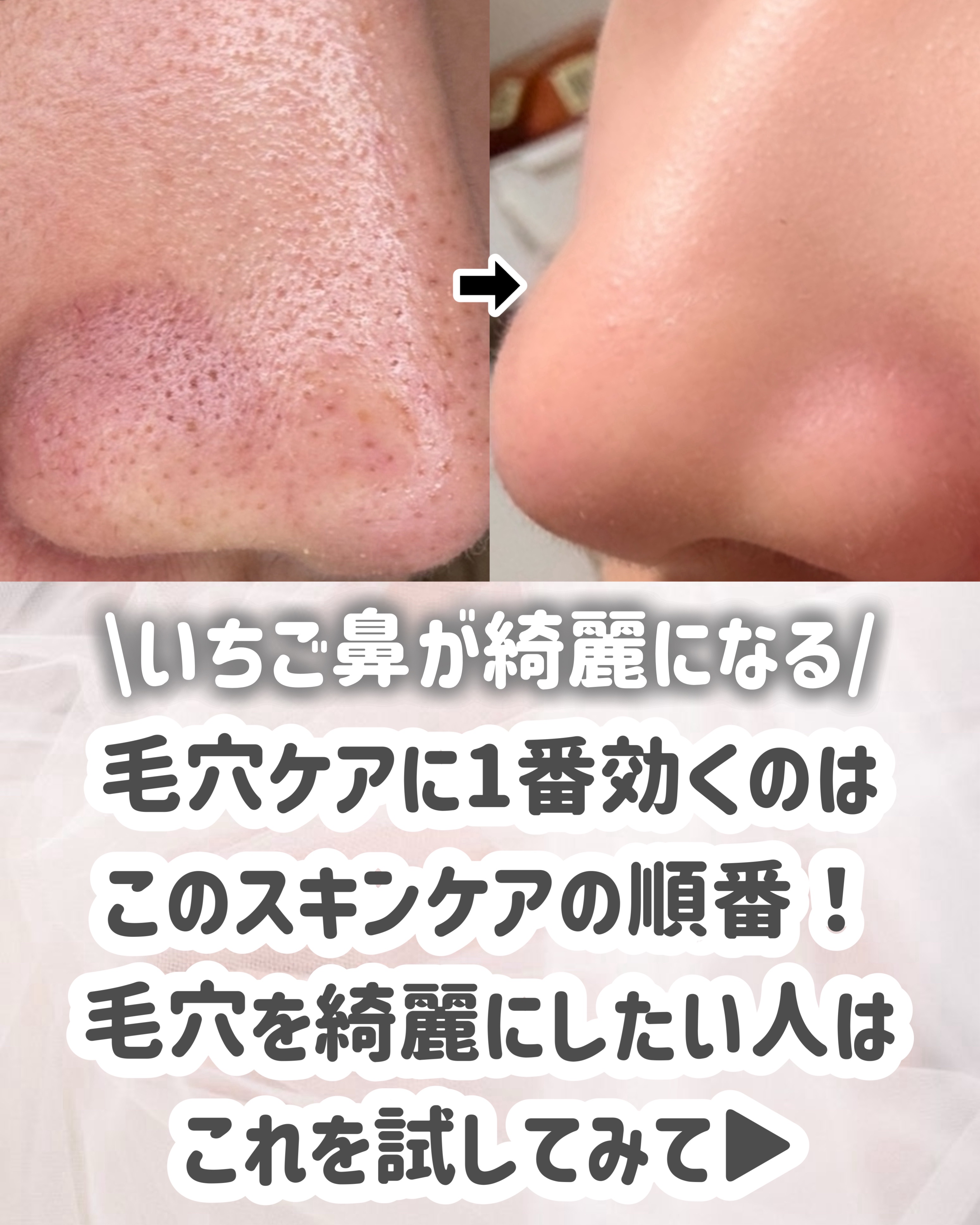 発酵導入美容液/無印良品/ブースター・導入液を使ったクチコミ（2枚目）