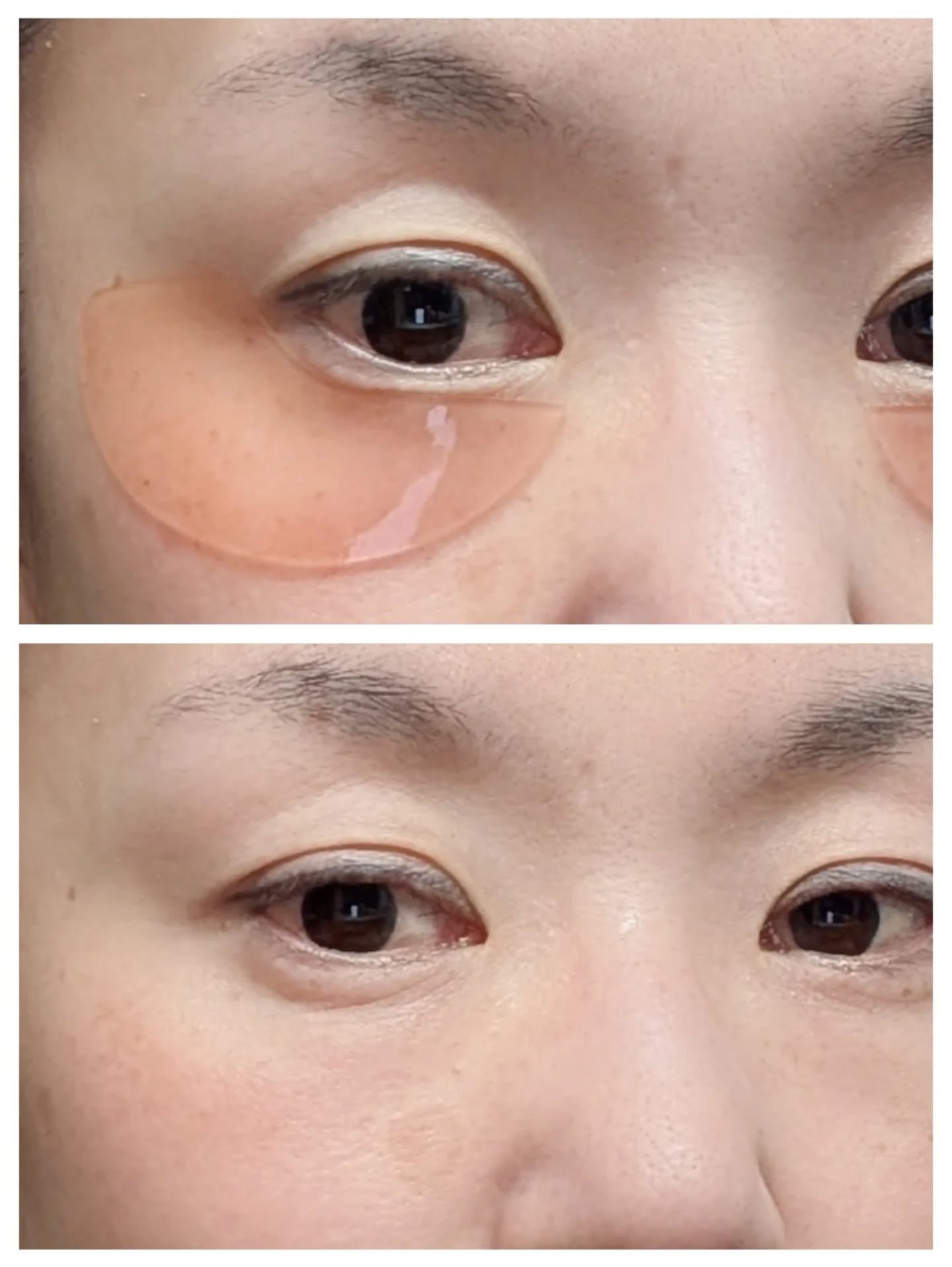 アイソイ 目元集中ケア アイゲルパッチ /ISOI/アイケア・アイクリームを使ったクチコミ（3枚目）