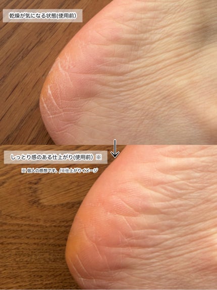 HiTOKi(ハイトキ) 保湿バーム 飛騨山 熊の油/HiTOKi/ボディローションを使ったクチコミ(3枚目)