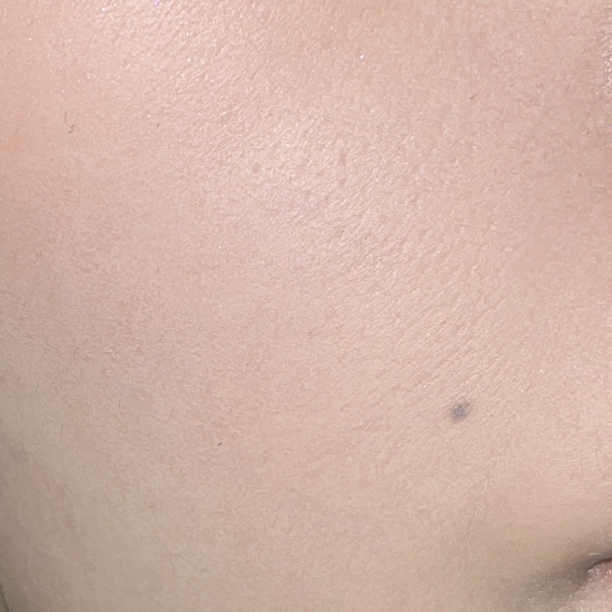 RMK Wトリートメントオイル/RMK/ブースター・導入液を使ったクチコミ（2枚目）