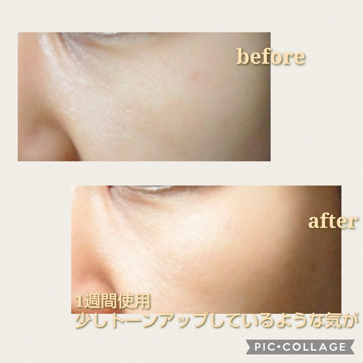 グルタチオン トーンオンセラム/VT/美容液を使ったクチコミ(8枚目)