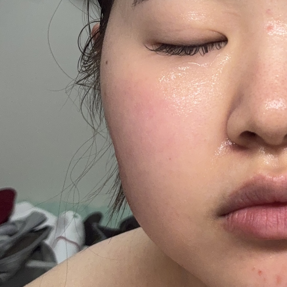 ハリマロ モイスト ショット 1000 50mL/ハリマロ/ブースター・導入液を使ったクチコミ（3枚目）