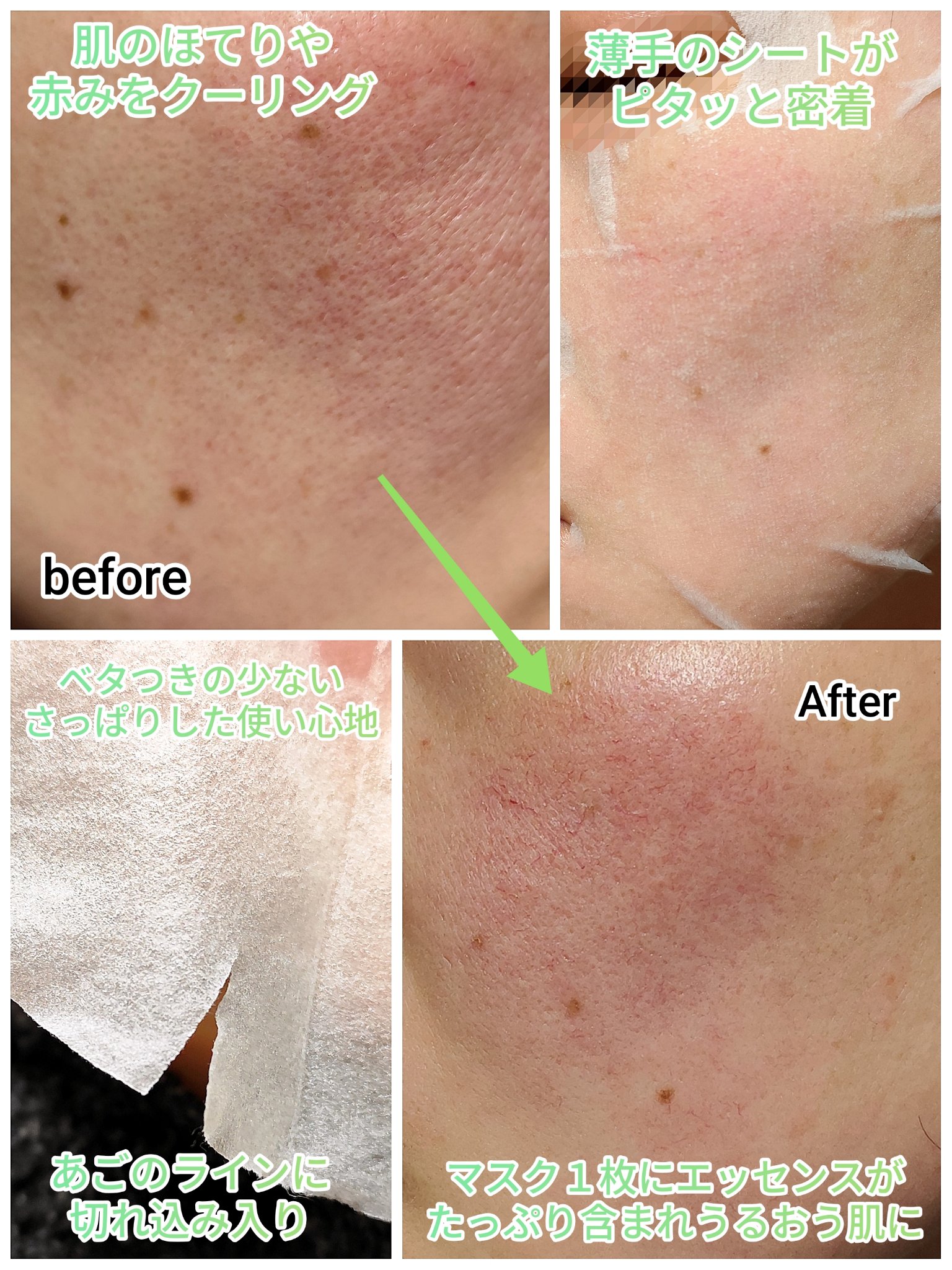 リアルセンテラシカデイリークイッククーリングマスク/PAPA RECIPE/シートマスク・パックを使ったクチコミ（3枚目）