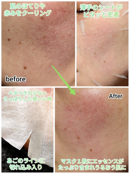 リアルセンテラシカデイリークイッククーリングマスク/PAPA RECIPE/シートマスク・パックを使ったクチコミ(3枚目)