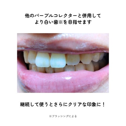 ホワイトニングパープルコレクターマウスウォッシュ/EUTHYMOL/マウスウォッシュ・スプレーを使ったクチコミ(5枚目)