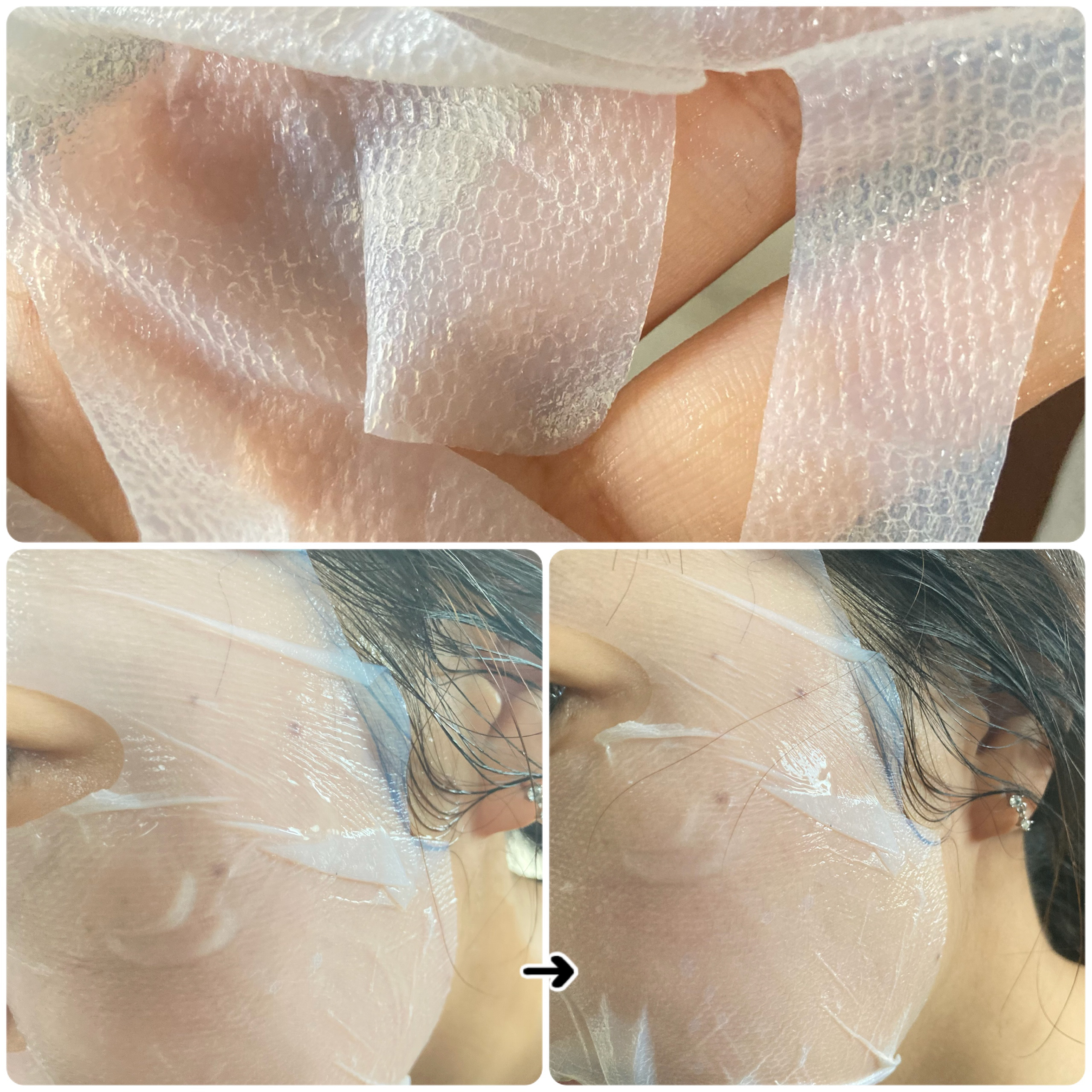 トラブルターゲティングセラム/EIOM/美容液を使ったクチコミ（2枚目）