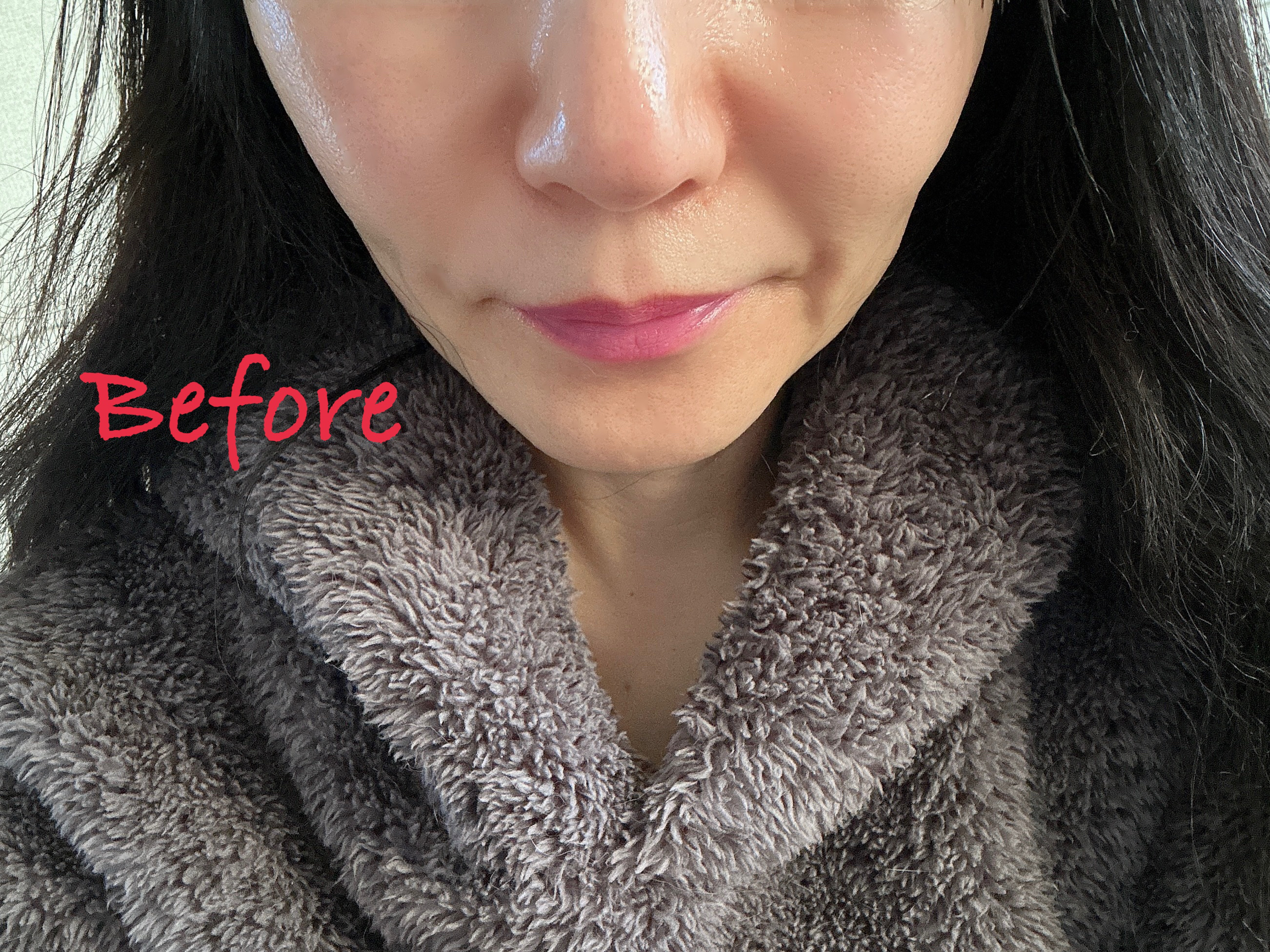 C×AZ ダーマインショット200/ESIENCE/美容液を使ったクチコミ（2枚目）