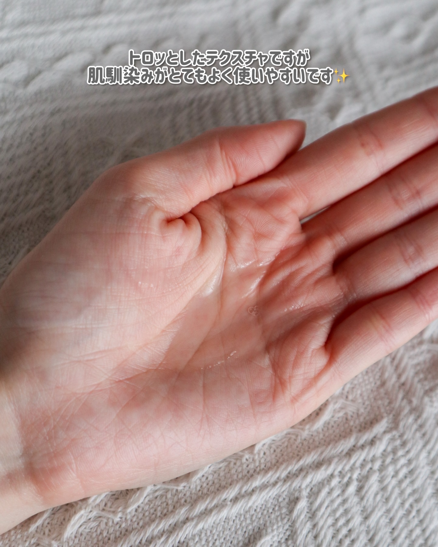 VC100エッセンスローション EX/ドクターシーラボⓇ/化粧水を使ったクチコミ（3枚目）