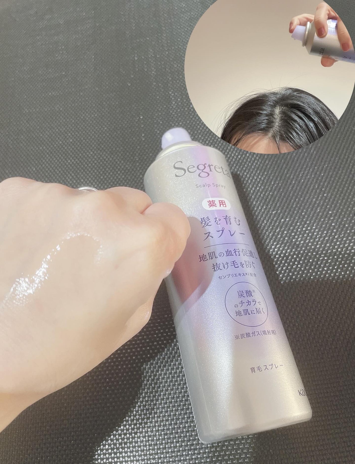 hana❁ フォロバ100 on LIPS 「最近、抜け毛や髪のボリュームが気になり始めて…「そろそろ育毛ケ..」(2枚目)