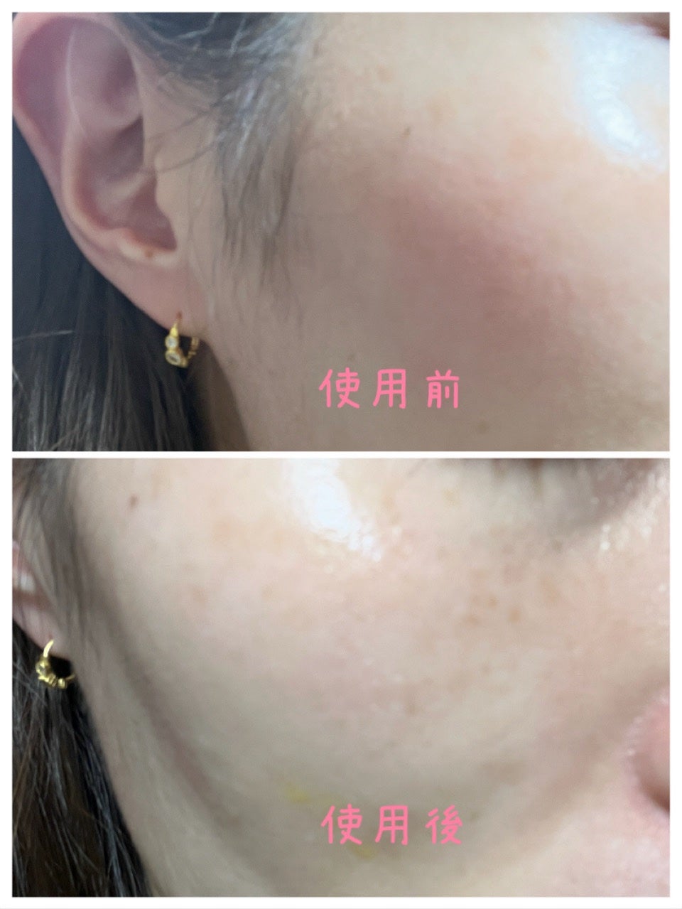 ダーメラ ルミショット・Wビタセラム/Dermela/美容液を使ったクチコミ(3枚目)