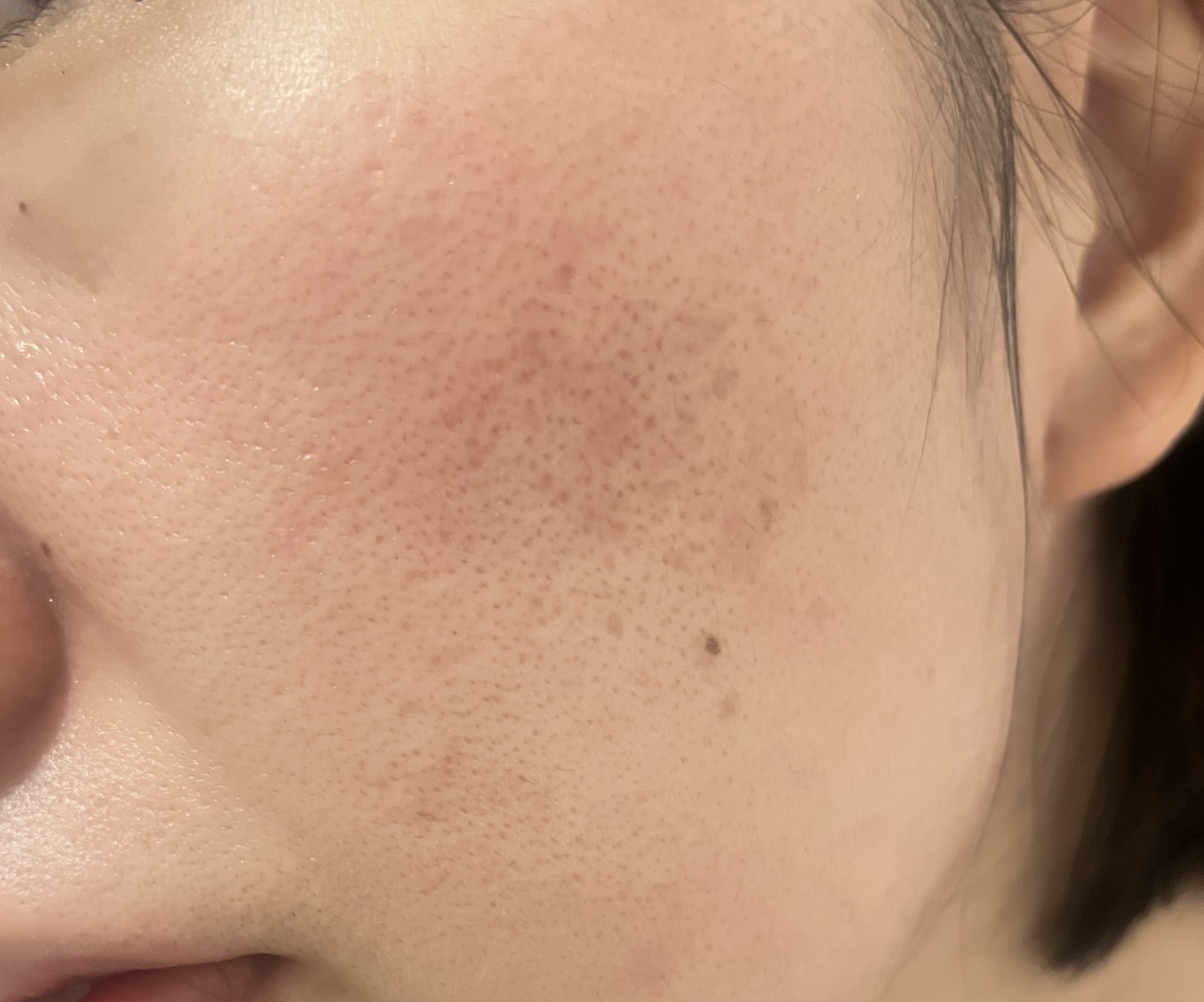 ザ・タイムR アクア/IPSA/化粧水を使ったクチコミ（2枚目）