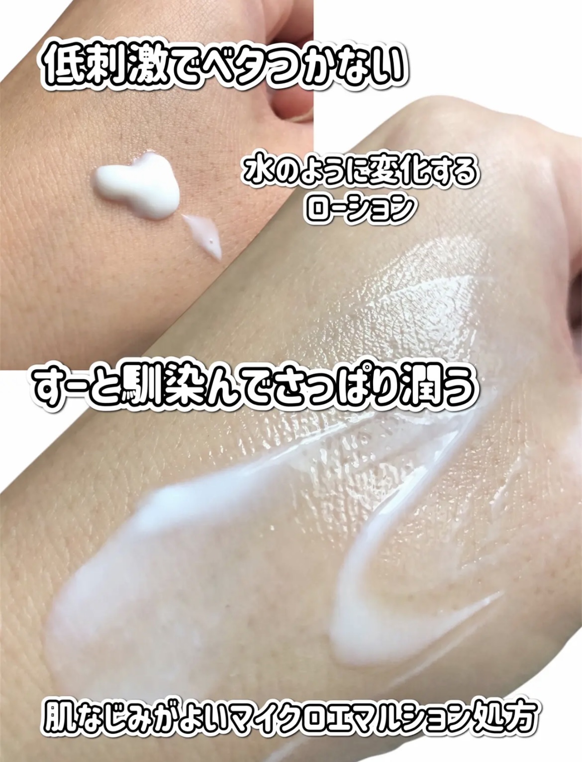 ユースキンシソラ ローション/ユースキン/ボディローションを使ったクチコミ（2枚目）