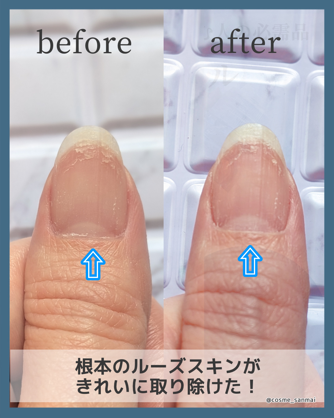 キューティクルリムーバー/MIKAGAMI/ネイルオイル・トリートメントを使ったクチコミ（2枚目）