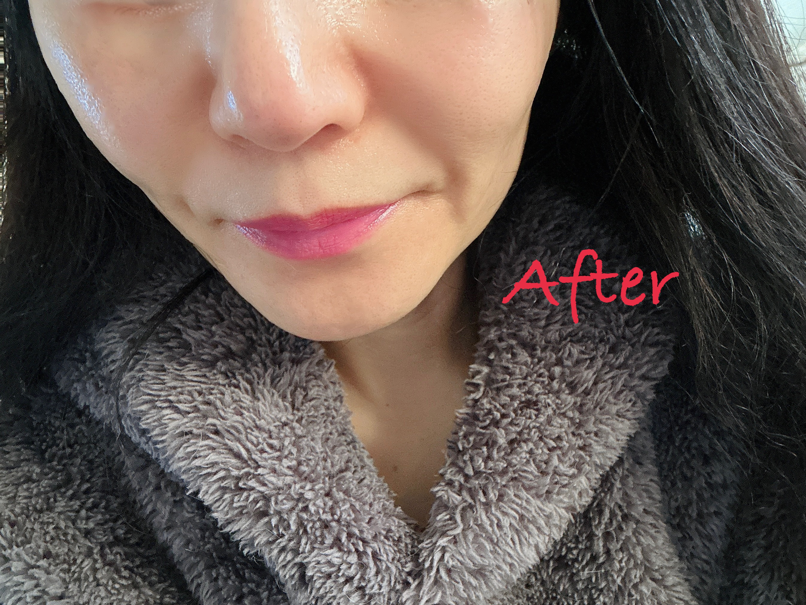 C×AZ ダーマインショット200/ESIENCE/美容液を使ったクチコミ（3枚目）