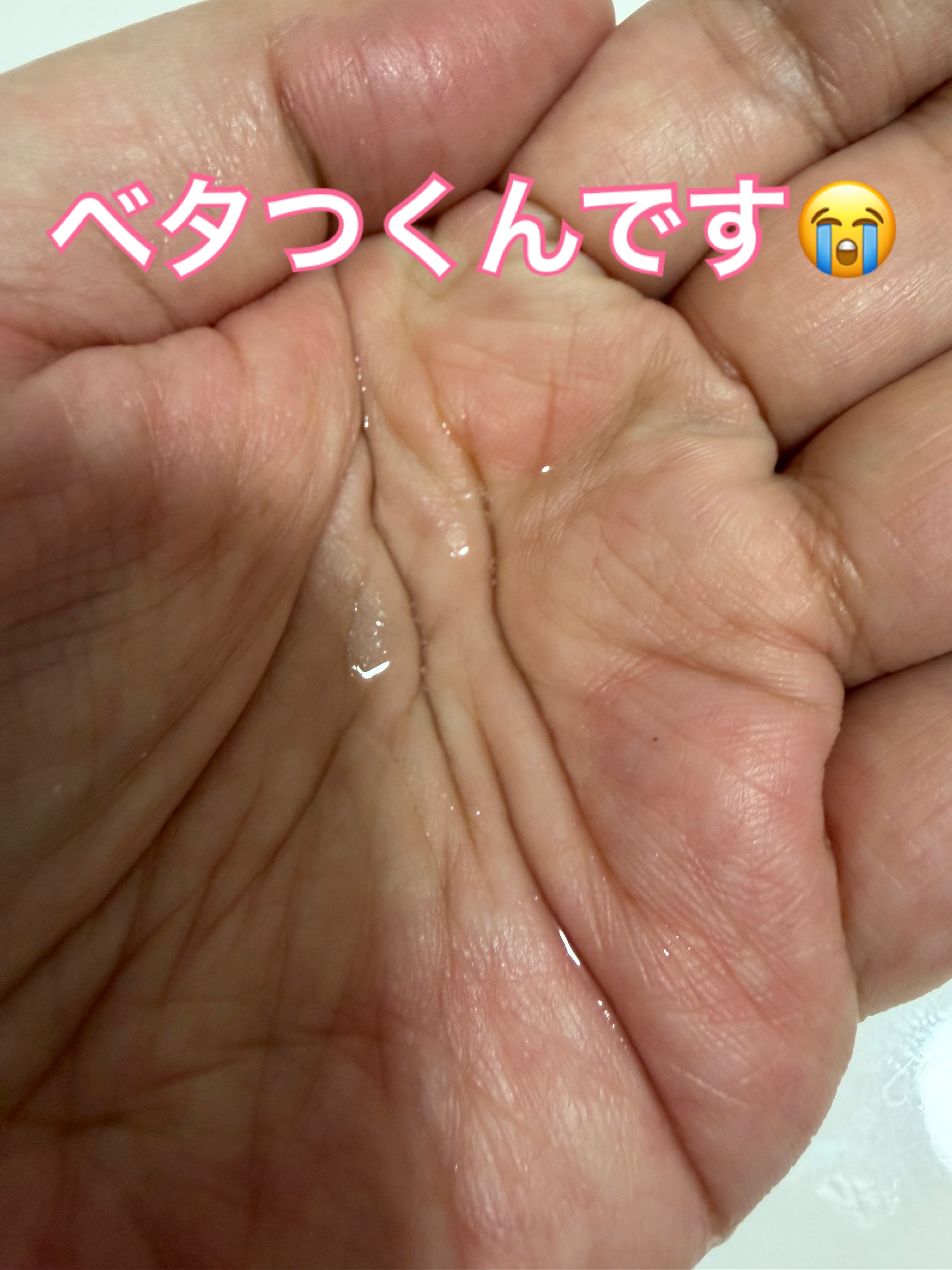 TXナイアシンエッセンストナー/SKIN&LAB/化粧水を使ったクチコミ（2枚目）