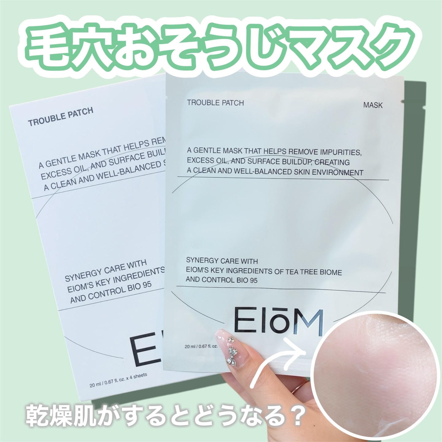 トラブルパッチマスク/EIOM/その他スキンケアを使ったクチコミ（1枚目）