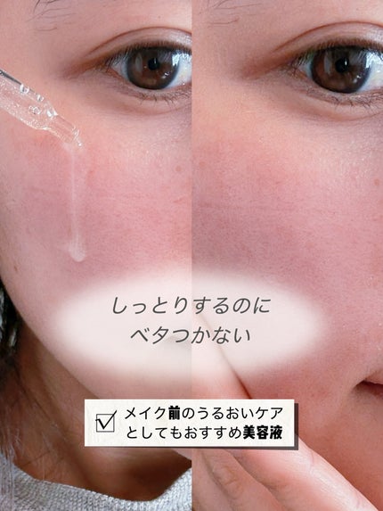 イドラビオ セラム ヒアルプラス/ビオデルマ/美容液を使ったクチコミ(2枚目)