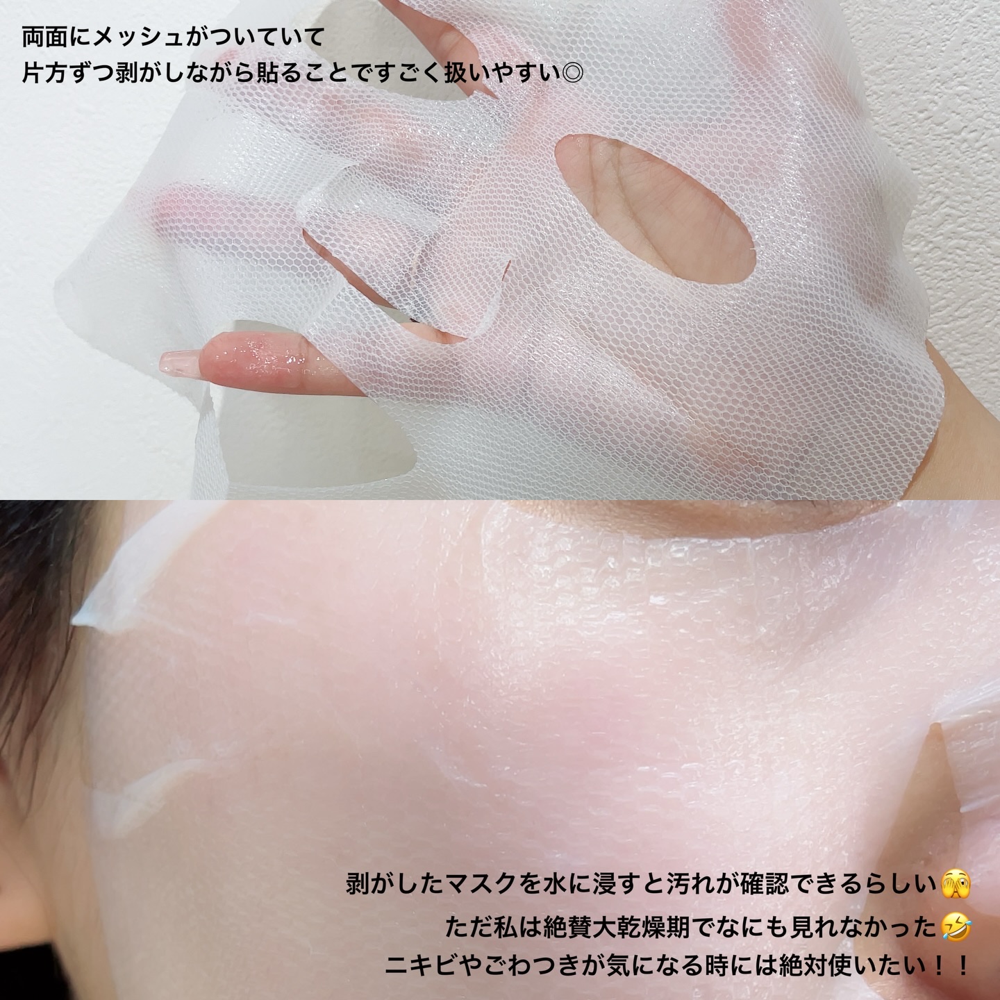 トラブルパッチマスク/EIOM/その他スキンケアを使ったクチコミ（3枚目）