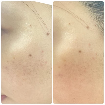 カネボウ ジェネレイティング エッセンシャルズ/KANEBO/化粧水を使ったクチコミ(4枚目)