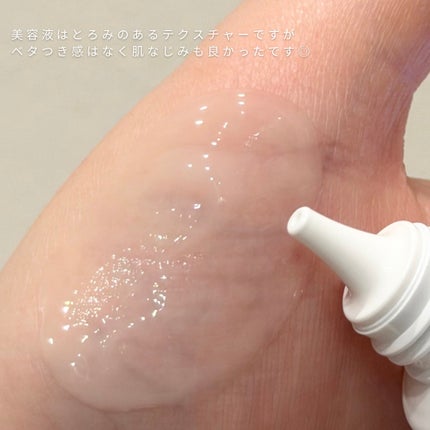 チョコブラ スペシャル毛穴ケアセット/Chocobra/スキンケアキットを使ったクチコミ(4枚目)