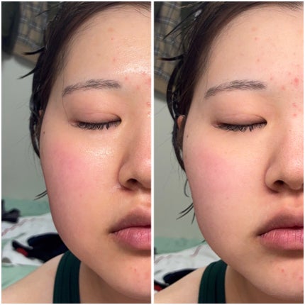 トラブルターゲティングセラム/EIOM/美容液を使ったクチコミ(2枚目)