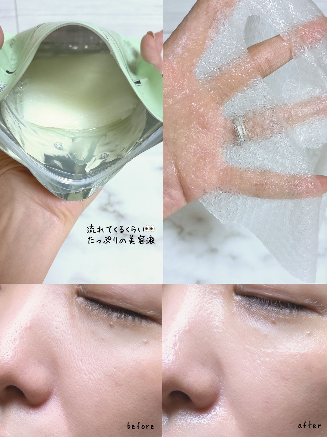 リードルS レチA EXマスク/VT/シートマスク・パックを使ったクチコミ（2枚目）