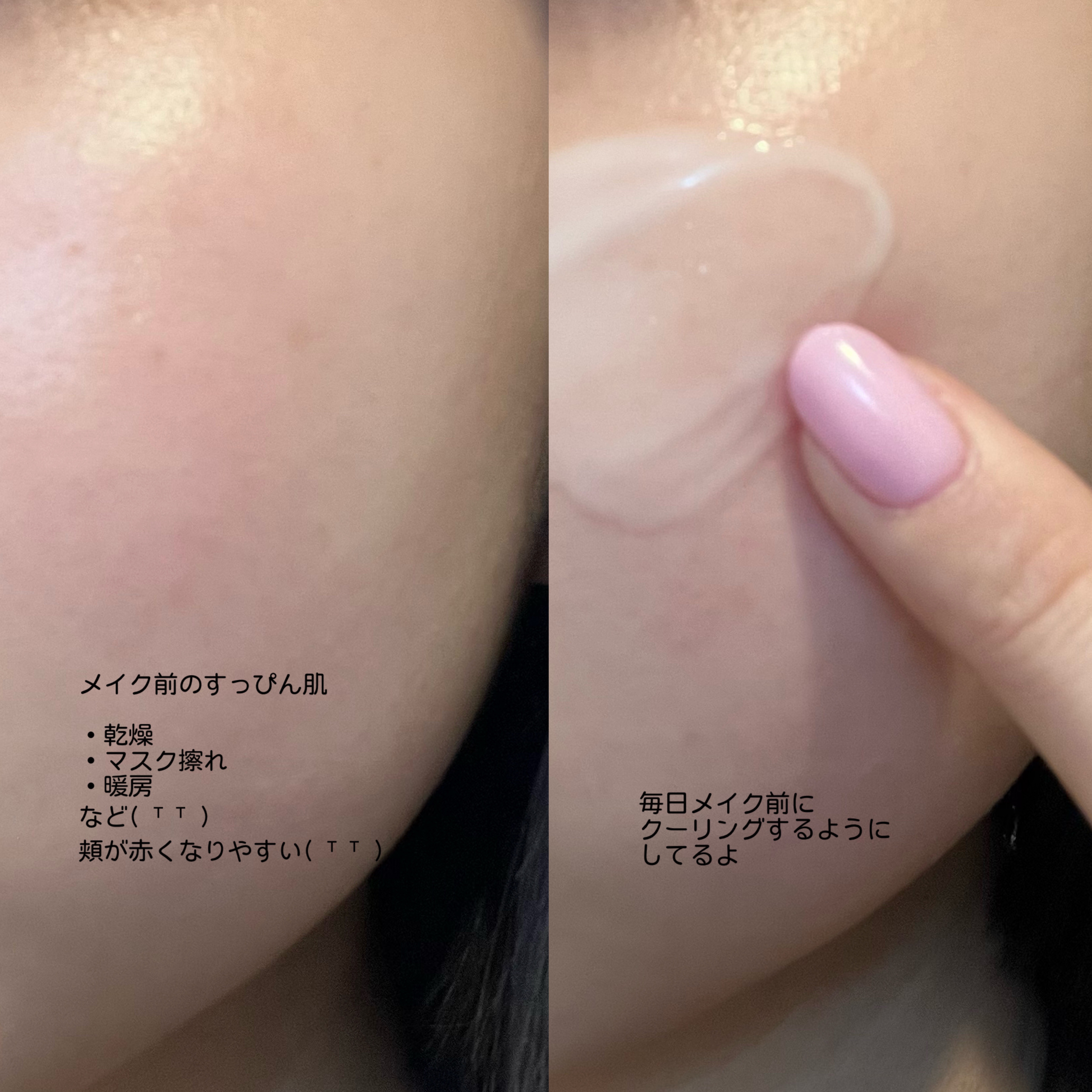 レッドブレミッシュ クリアスージングクリーム/Dr.G/フェイスクリームを使ったクチコミ（2枚目）