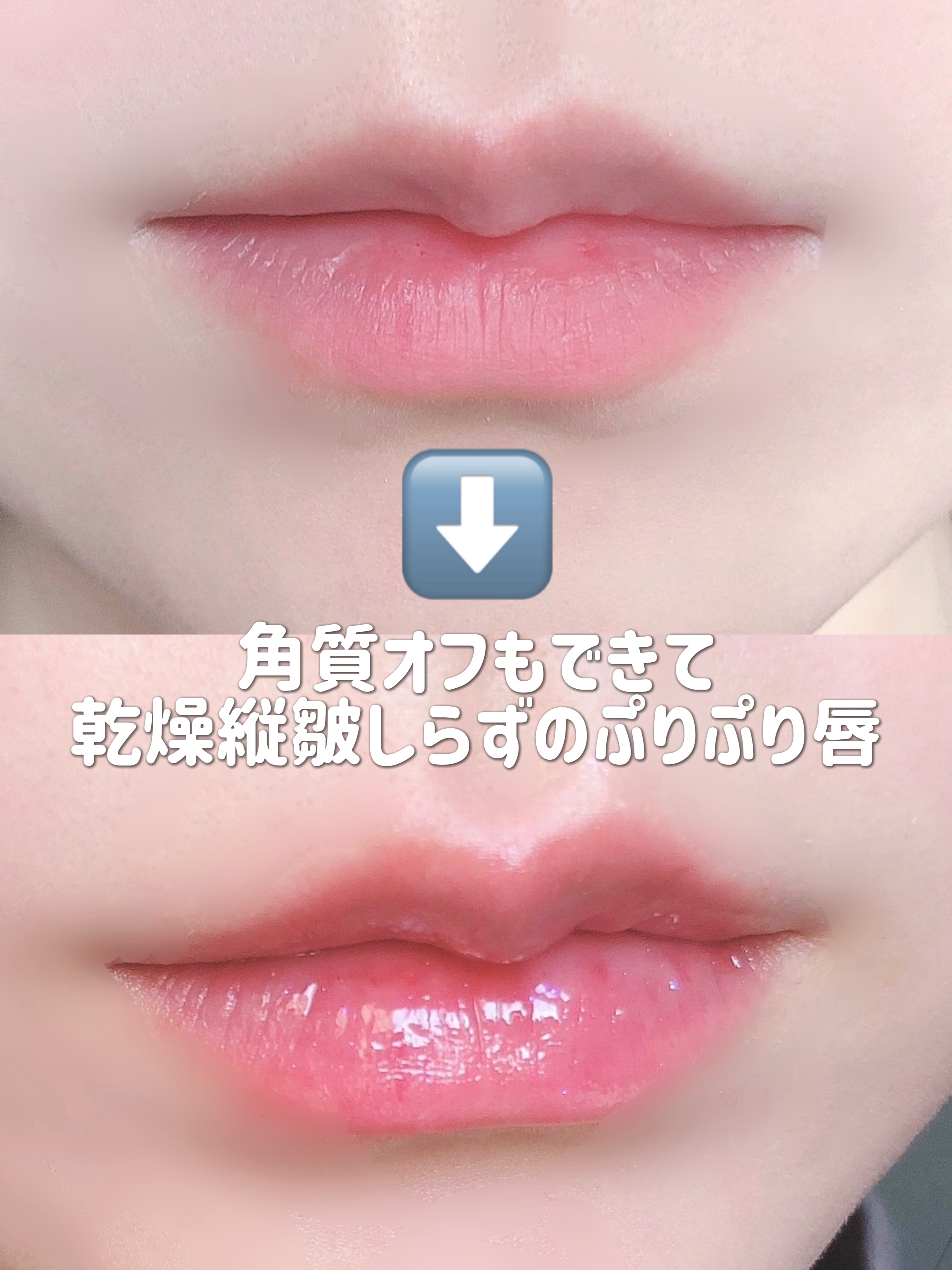 フレイムライトリッププランパー/LoNLy /リッププランパーを使ったクチコミ（3枚目）