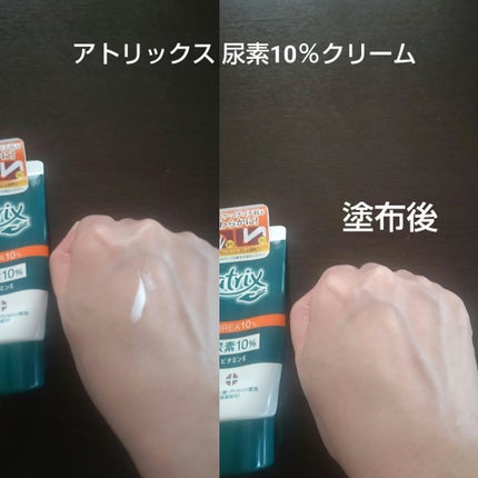 アトリックス 尿素10%クリームのクチコミ「最近の使い切りです。
🤍ルルルンプレシャス WHITE 光彩スイッチ 7枚入
ピリピリせず.....」(2枚目)